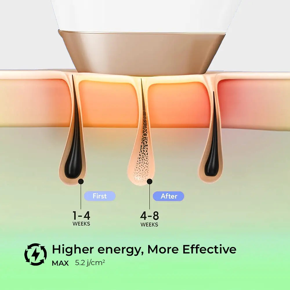 Nexso IPL Laser Hair Removal 999999 Flashes Cooling Tech